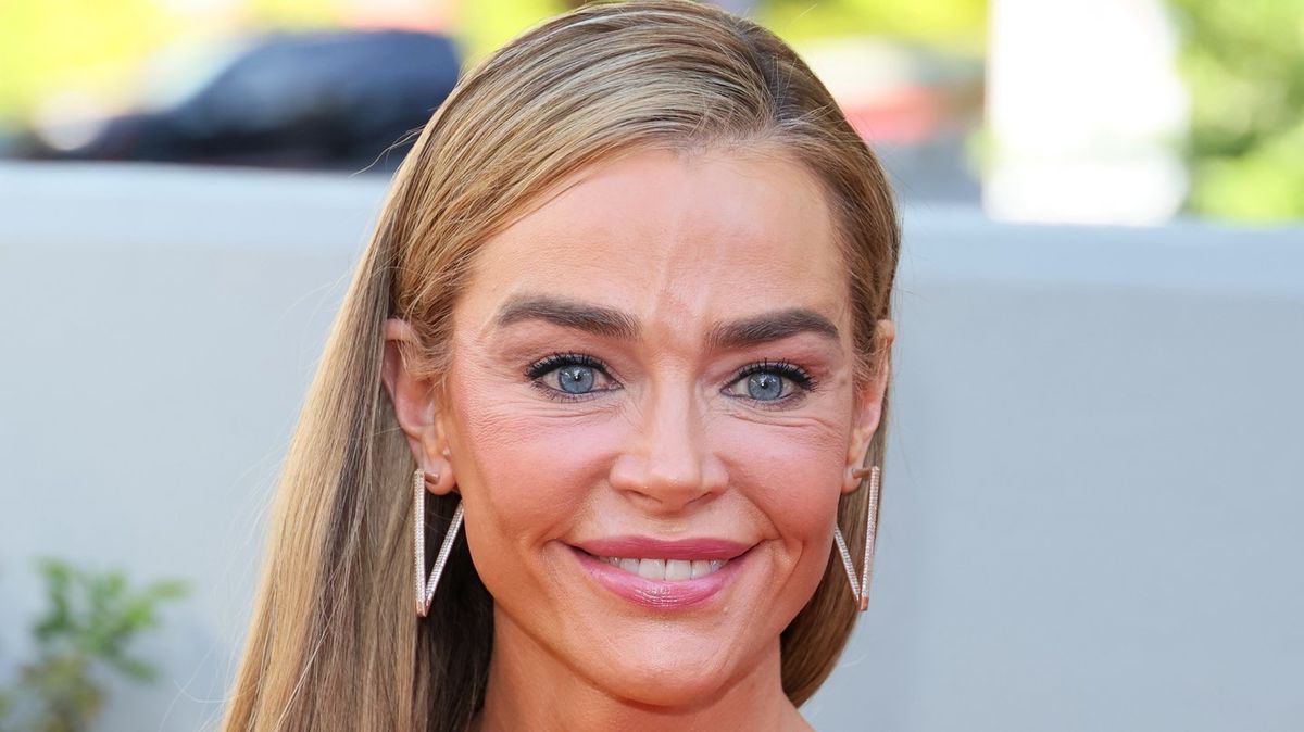 Denise Richards Reveals $200,000 Facelift to Defy Aging Amid Divorce