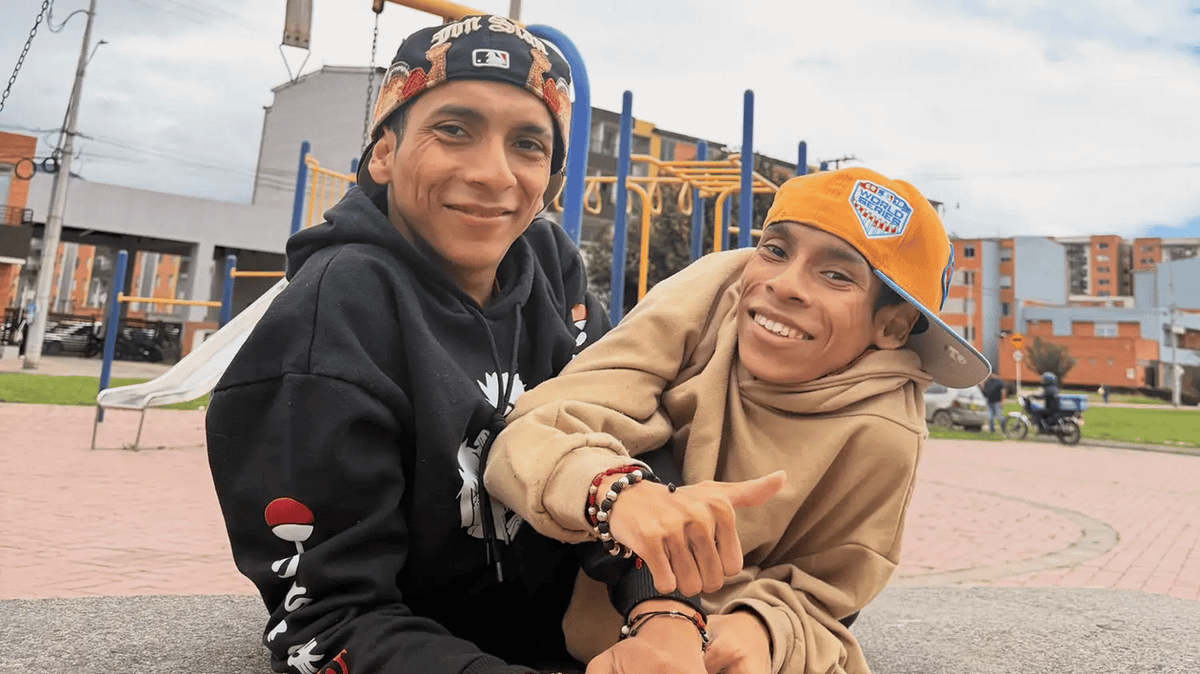 Conjoined Twin Influencers Die After Separate Heart Attacks at 27