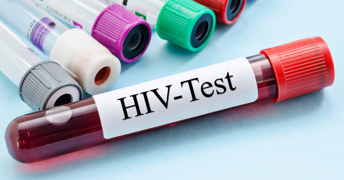 Epidemia de HIV din Rusia atinge stadiul generalizat în 27 de regiuni, afectând masiv populația
