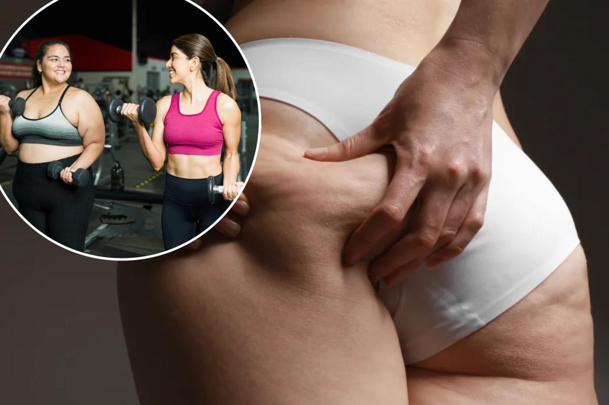 Breakthrough Drug Promises to Prevent 'Ozempic Butt' - What's the Catch?