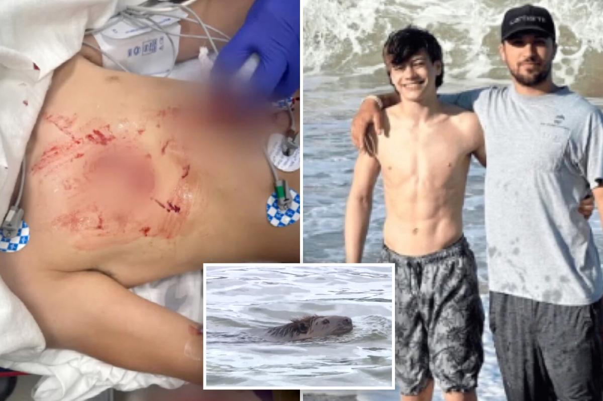 Teen's Harrowing Battle with Rabid Beaver at Maryland Park Captures Attention