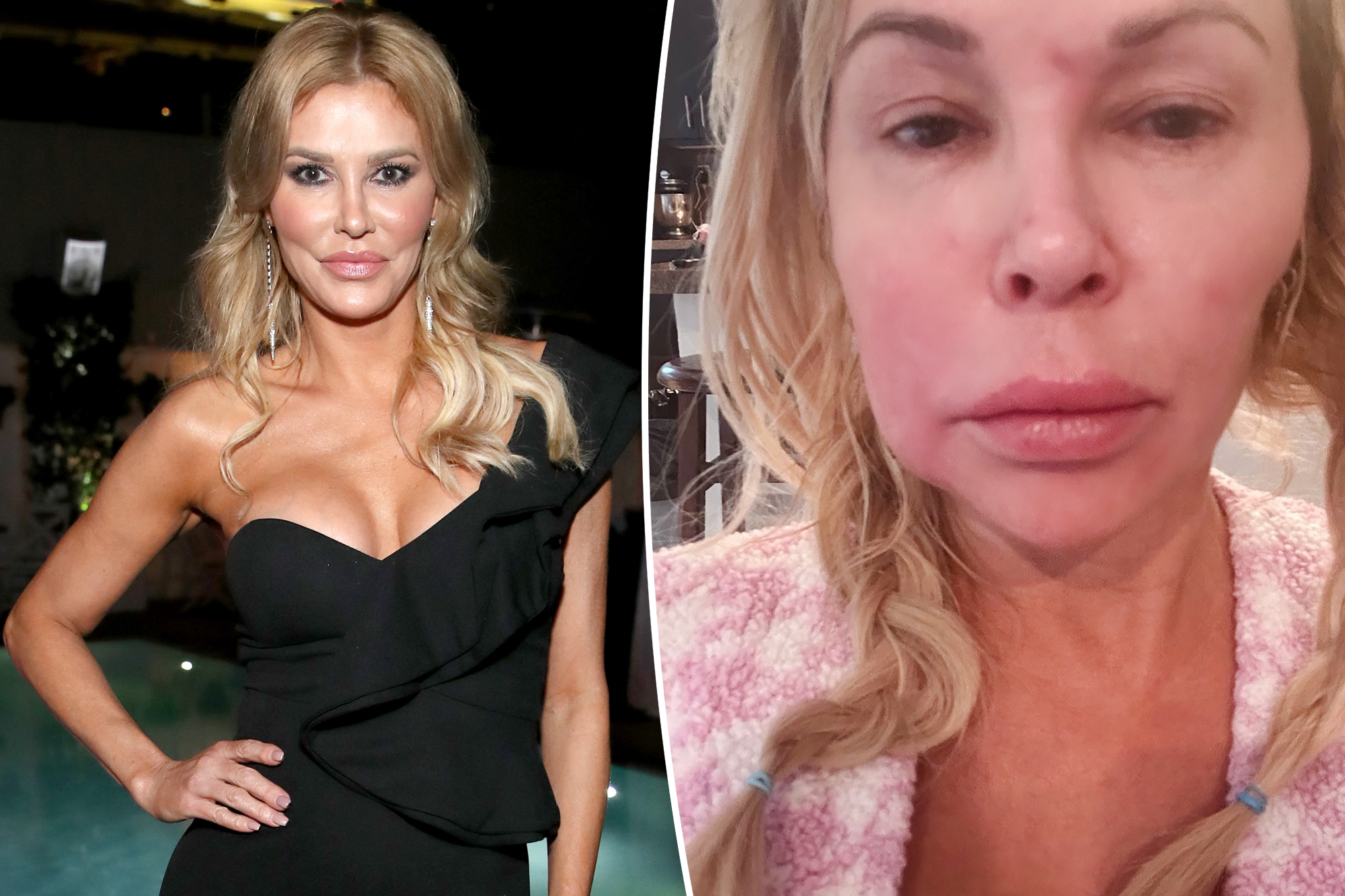 Brandi Glanville uncovers source of facial parasite that aged her rapidly