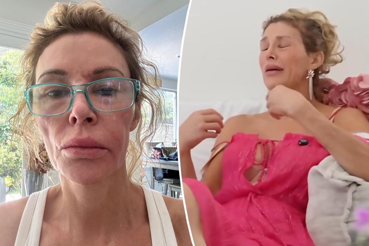 Brandi Glanville's Tearful Confession: The GoFundMe She Never Wanted
