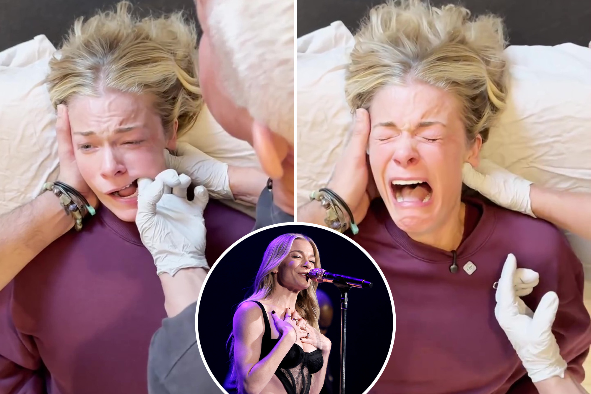 LeAnn Rimes' Emotional Jaw Therapy: Experts Explain Her Reaction