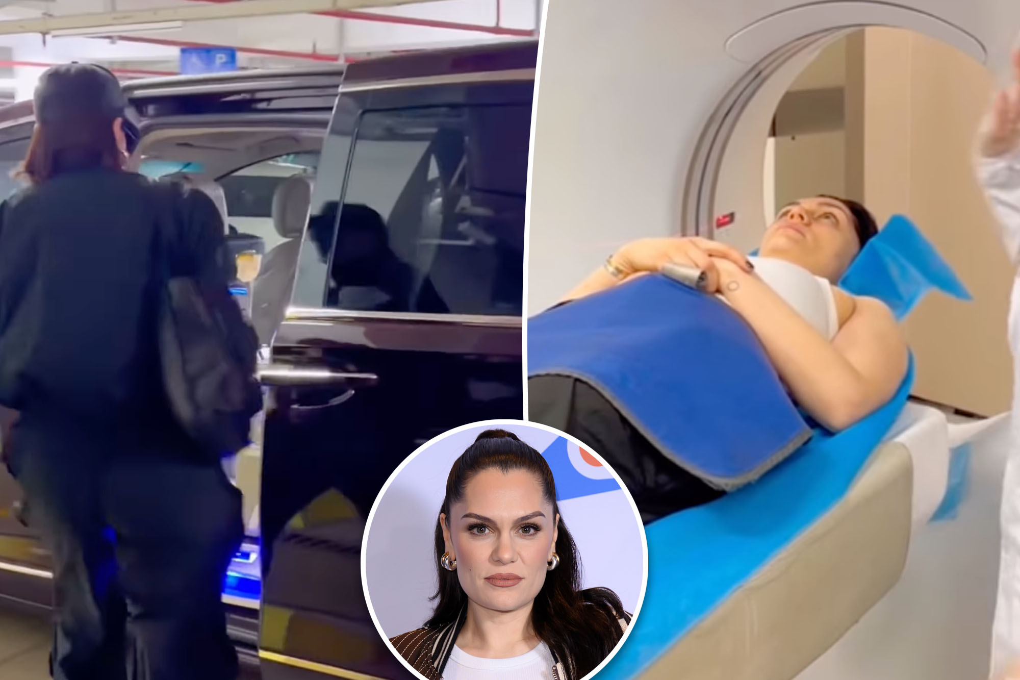 Jessie J's Scary Hospital Visit After Hitting Head on Car Roof!