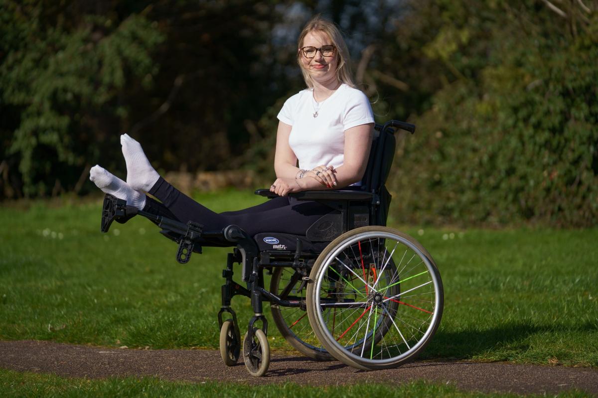 Megan Dixon's Brave Decision: The Amputation Journey That Shocked Everyone