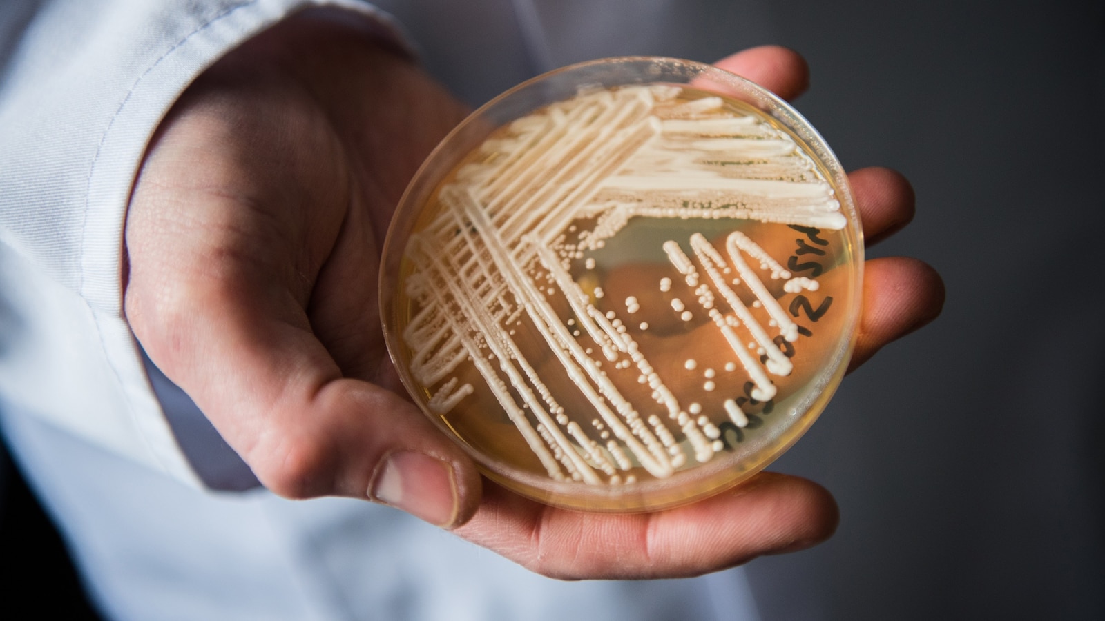 Why the Candida Auris Fungus is Raising Alarms Across 23 States