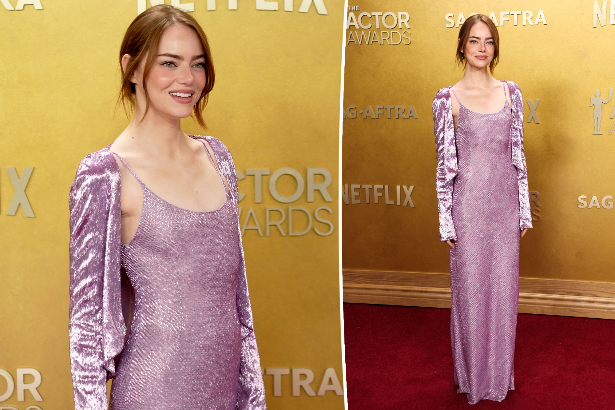 Emma Stone's Lavish Cardigan Turns Heads at SAG Awards 2026