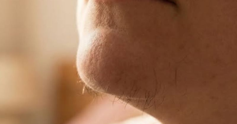 What Chin Hair in Women Indicates About Hormones