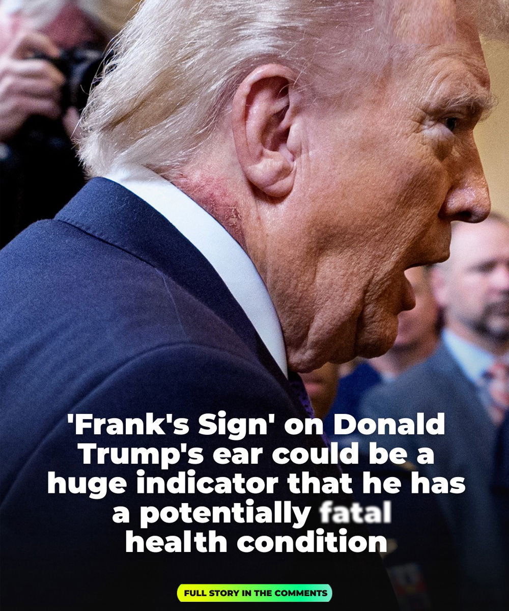 The Hidden Ear Sign on Donald Trump That Could Signal Serious Health Risk