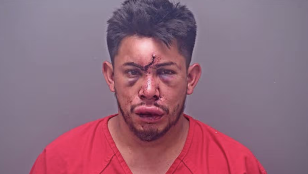 Alabama Teen Allegedly Leaves Father Unconscious in Family Dispute