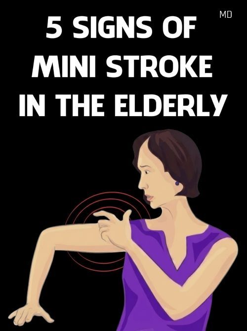 Warning Signs: Older Adults' Key Clues to Detect a Mini-Stroke