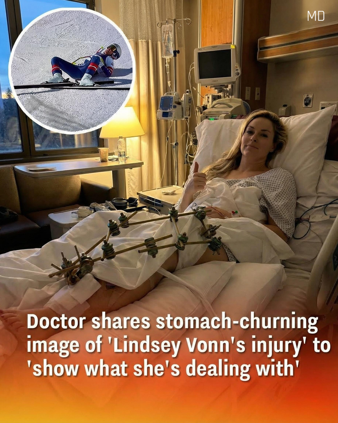 Lindsey Vonn's Severe Injury Explained by Doctor: Recovery Details Revealed