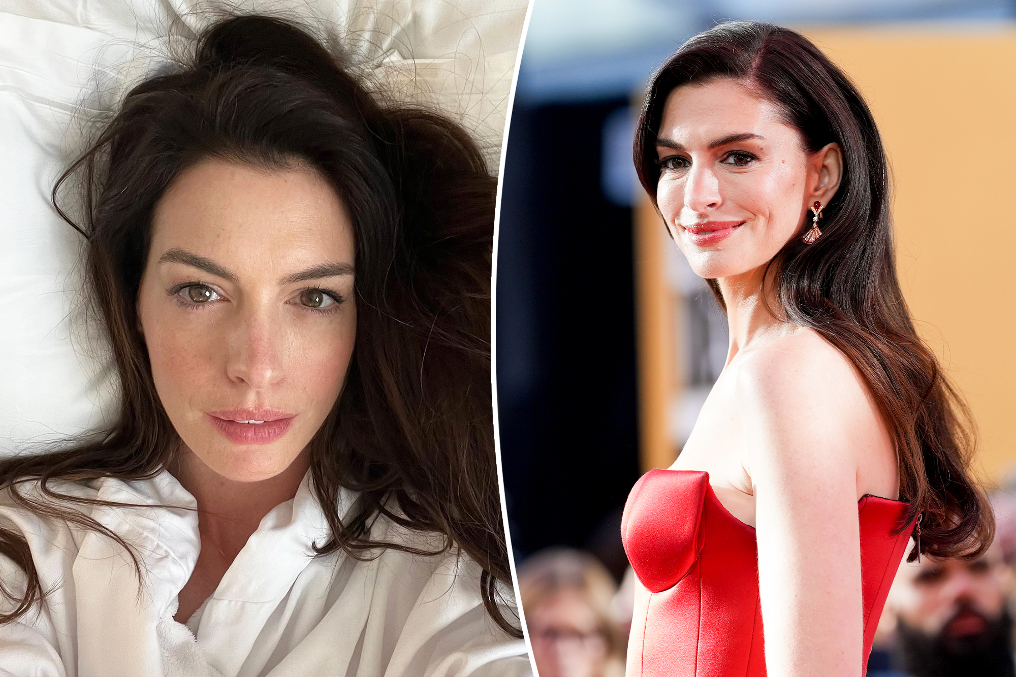 Anne Hathaway’s Go-To Facial: My Surprising Instant Facelift Experience