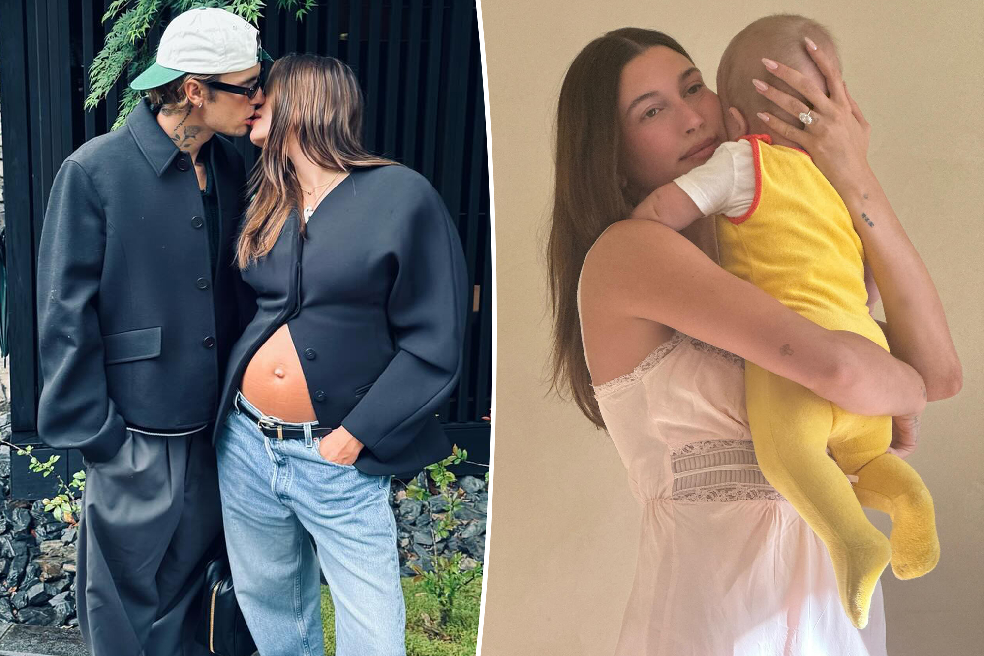 Hailey Bieber's Surprise Pregnancy: How a Uterine Septum Played a Role