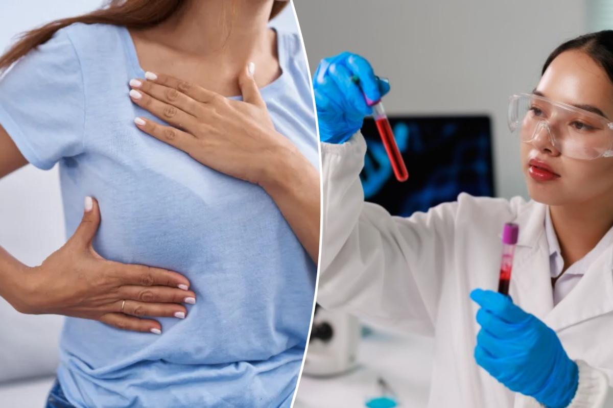 Older breast cancer gene tests missed dangerous variants in one in six women