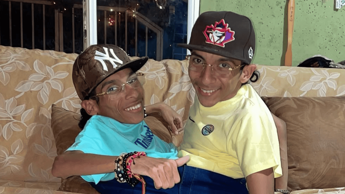 Conjoined Twin Influencers Pass Away at 27 After Heart Attack Tragedy