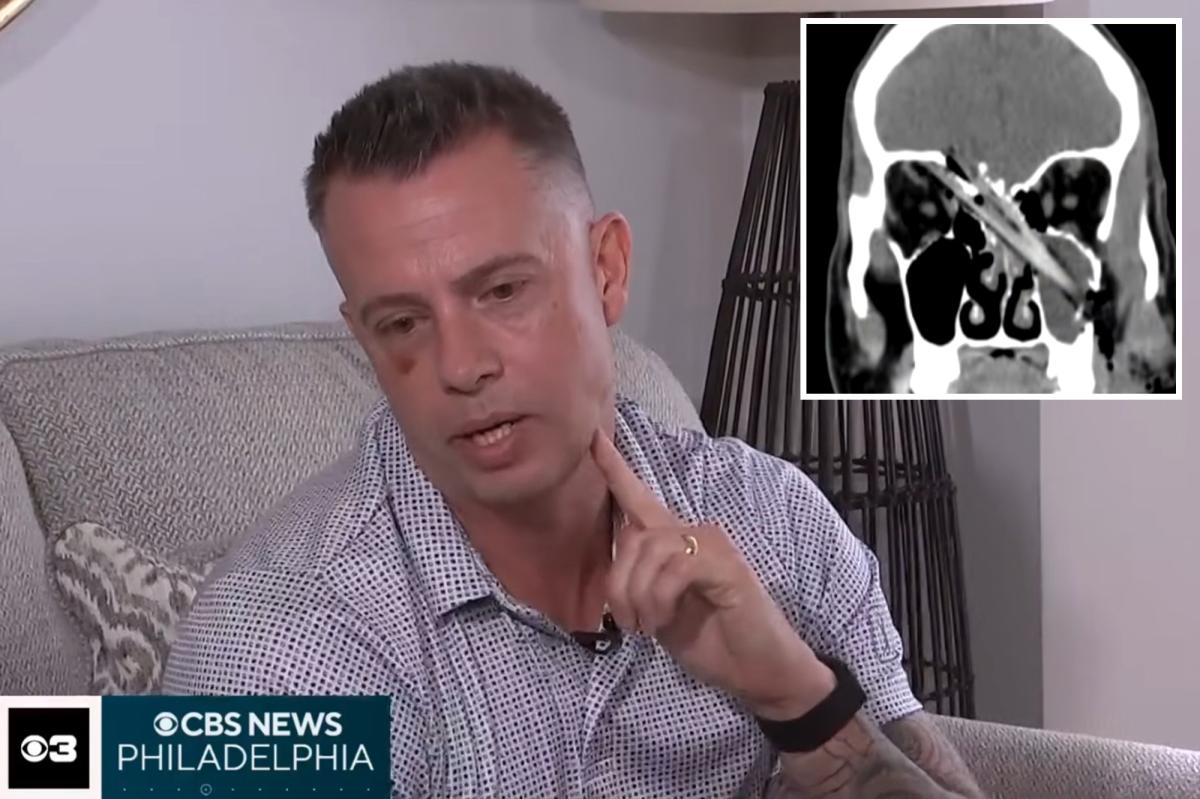 NJ Dad's Unbelievable Survival After Tree Branch Impales Brain