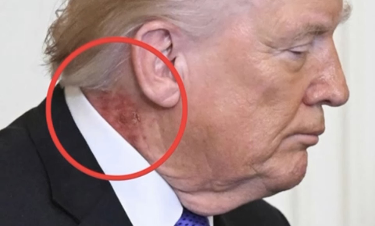 Why Trump's Latest Photo is Stirring Health Concerns