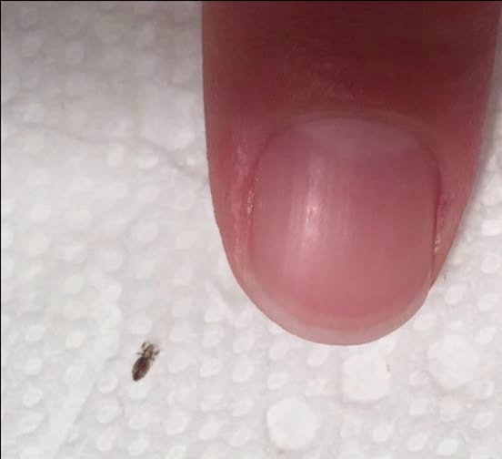 Your Must-Know Guide to Beating Head Lice for Good