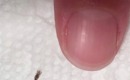 How to Remove and Prevent Bugs Found in Your Hair